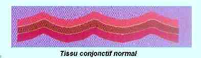 tissu sain