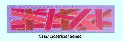 tissu cicatriciel