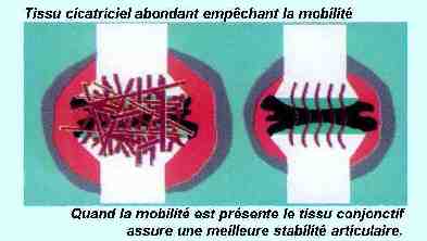 L'articulation face au traumatisme